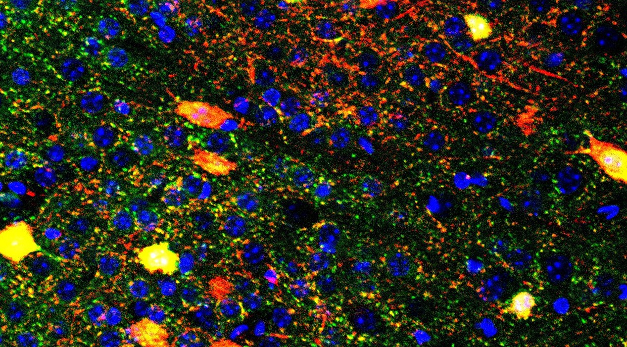 Immunostaining of HA-tagged to ribosomes (green) and Td-tomato (red) filling up PV interneurons.