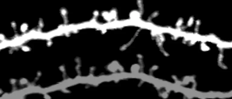 Black and white view of apical dendritic segments imaged with in vivo 2-photon microscopy. 