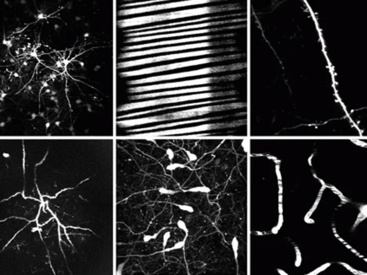 Logo of Portera-Cailliau Lab with black and white panel of cells.